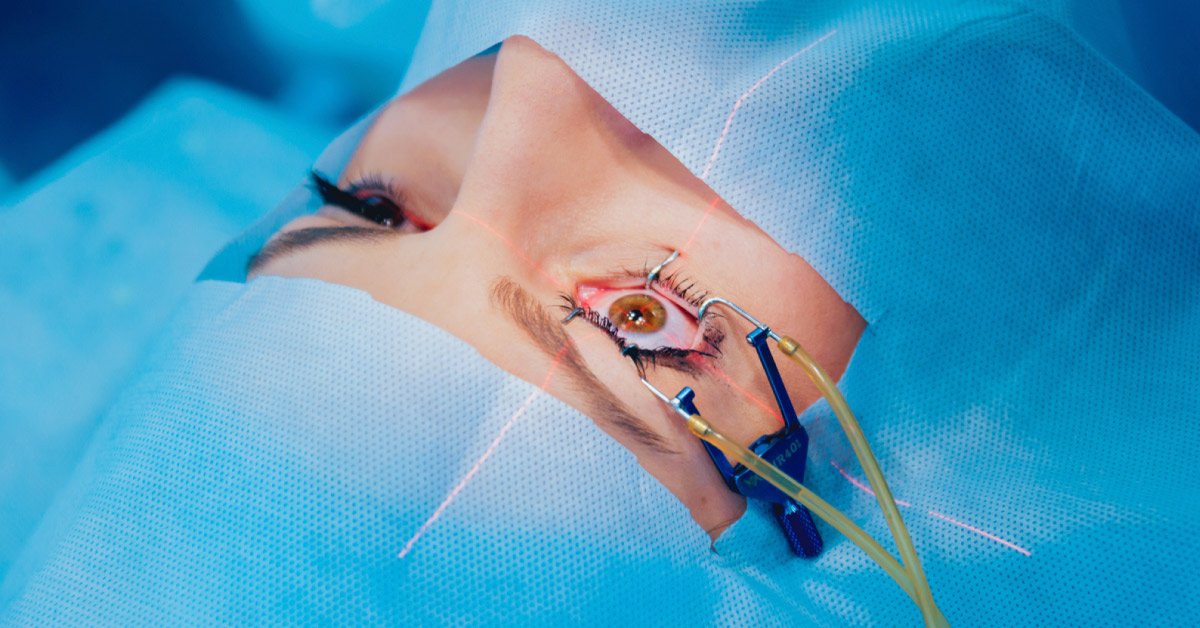 Cirurgia refrativa a laser | COH