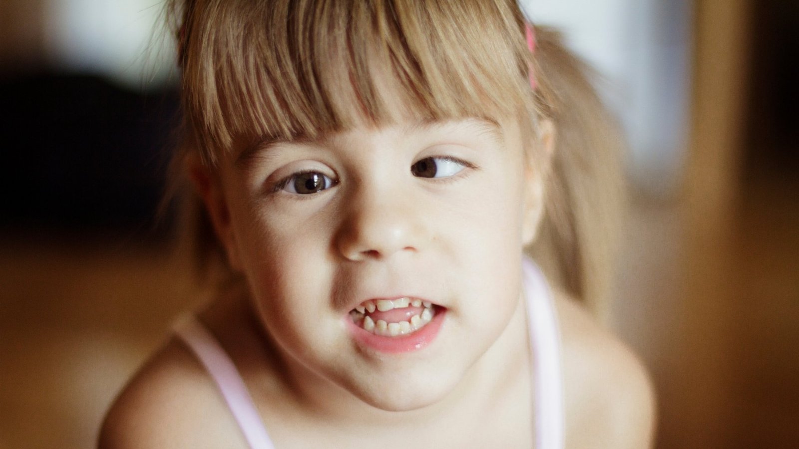 Estrabismo | Hospital de Olhos Vasconcelos Neto